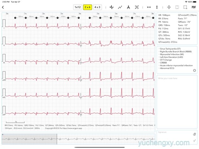 心电图书 ECG Pro for Doctors 医疗-第1张