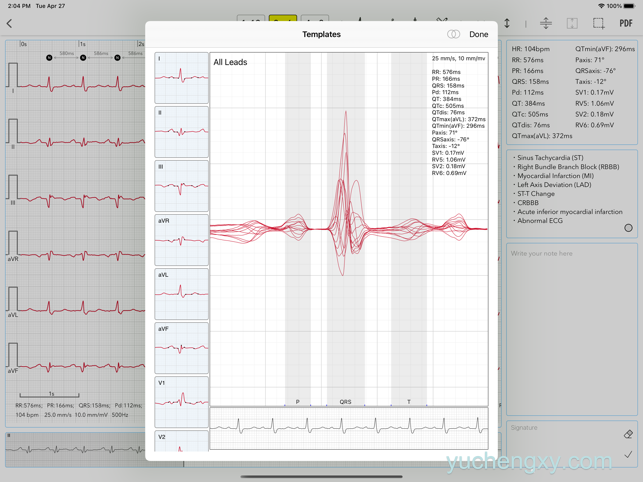 心电图书 ECG Pro for Doctors 医疗-第2张