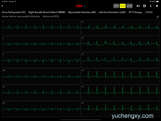 心电图书 ECG Pro for Doctors 医疗-第3张