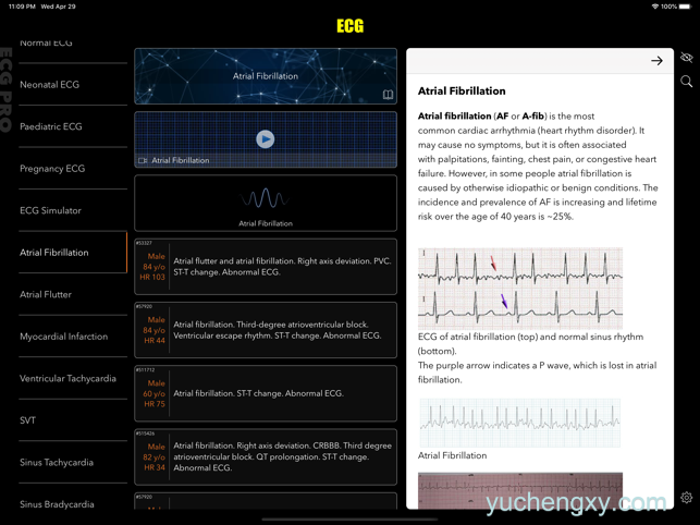 心电图书 ECG Pro for Doctors 医疗-第4张